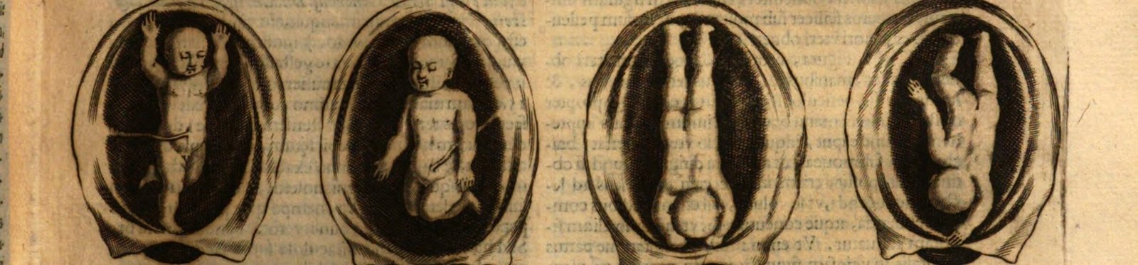  Illustration taken from Daniel Sennert: Medicinae Practicae Tomas Secundus. Venedig: Baba, 1641, S. 153.